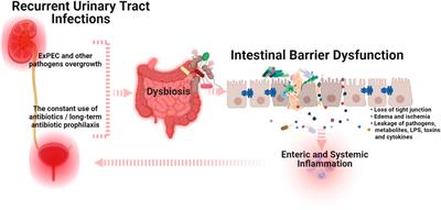 How Advanced Is Our Understanding of the Role of Intestinal Barrier Dysfunction in the Pathogenesis of Recurrent Urinary Tract Infections